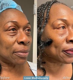Beauty Precision MD